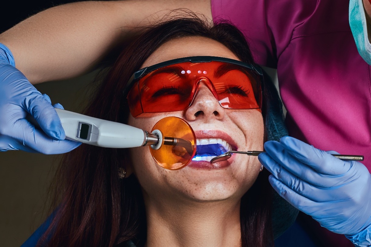 Vrouw ondergaat een cosmetische tandheelkundige behandeling bij iSmile Tandartspraktijk.